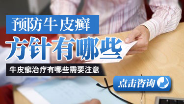 牛皮癣的护理方法有哪些